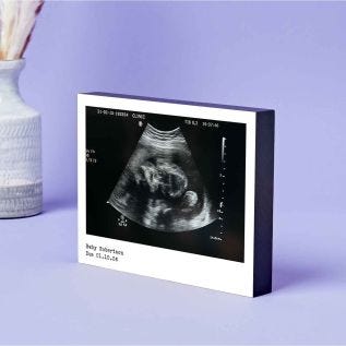 Baby-Scan-Retro-Print-Photo-Block-8x6-Black.jpg